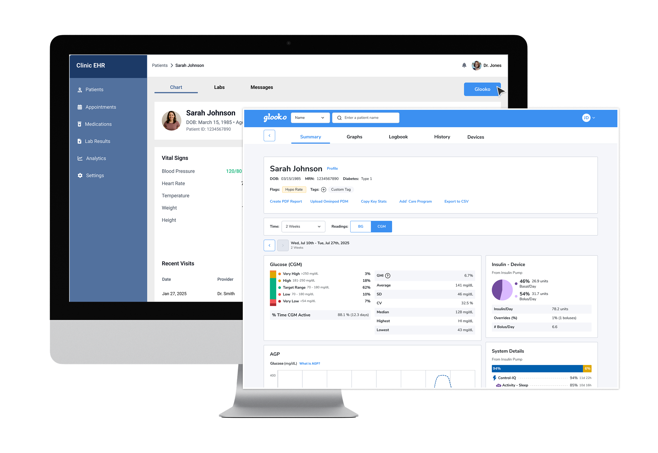 Diabetes Management For Healthcare Providers Glooko