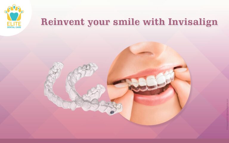 Invisalign Doctor Site Login Archives Elite Dental Care
