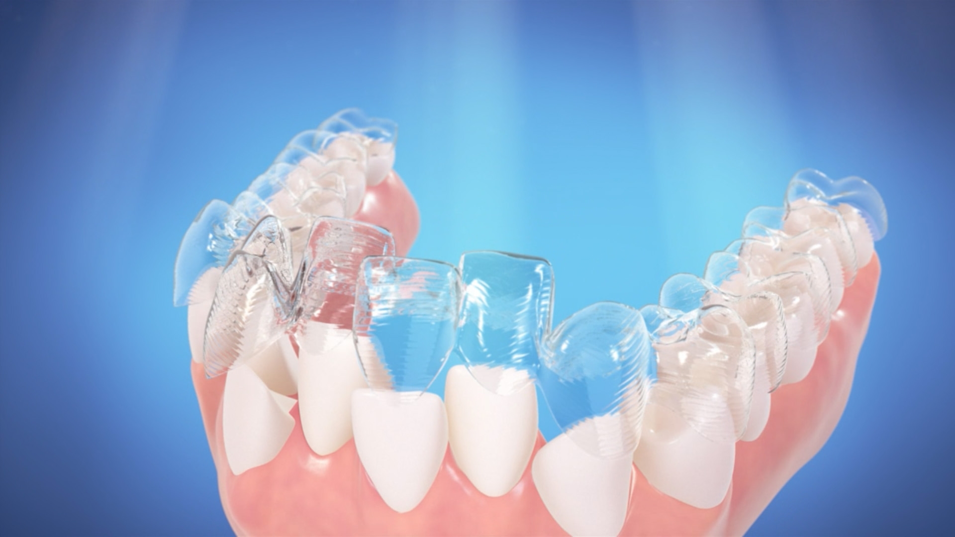invisalign doctor site login