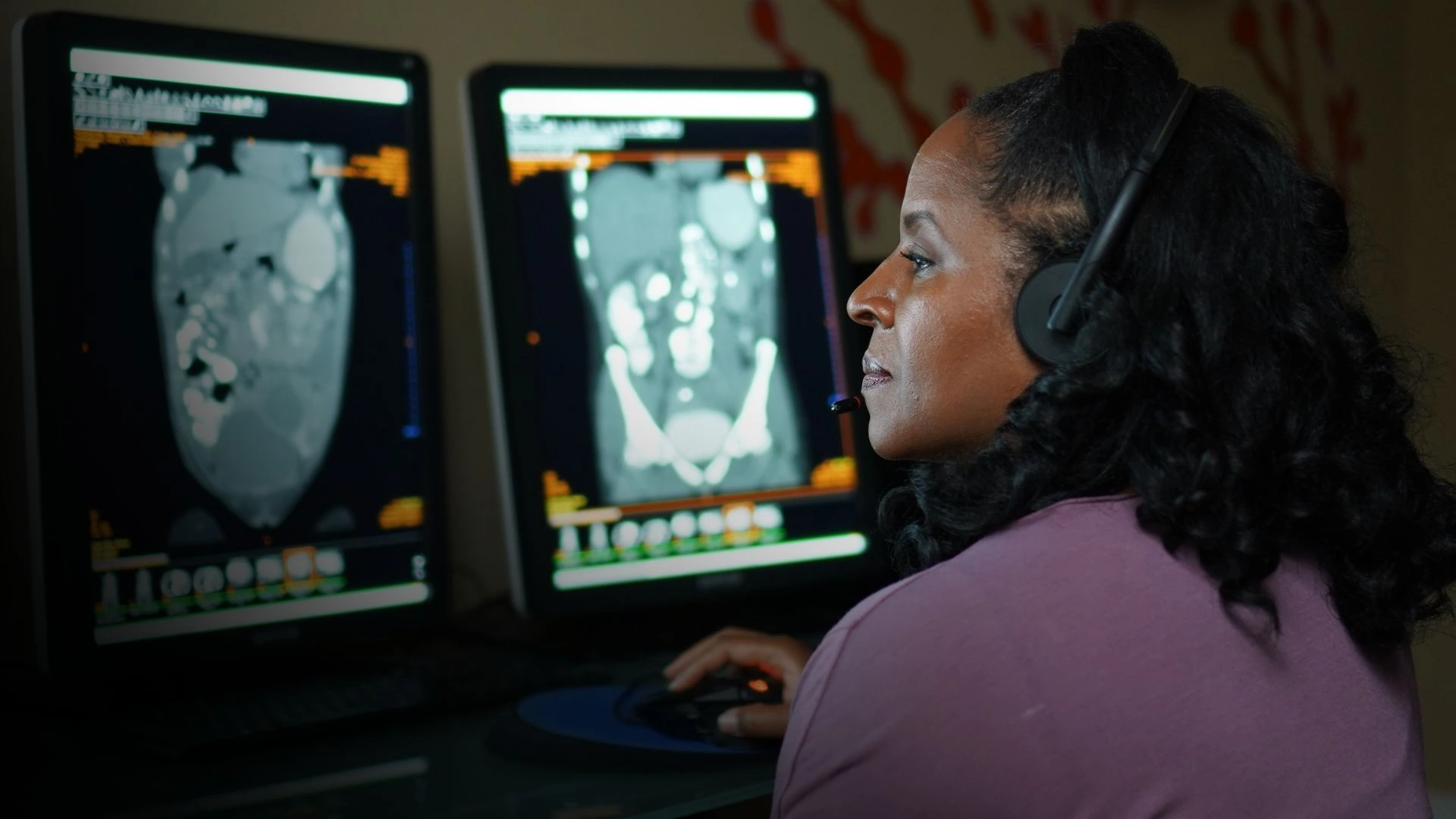 Teleradiology Services VRad